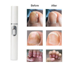 Load image into Gallery viewer, 1 Pcs Anti-fungal Home Set Laser Pen Finger Toe Nail Fungus Care Kit(White ) TSLM1